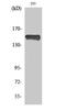 Phospholipase C-gamma-1 antibody, A00677Y783-1, Boster Biological Technology, Western Blot image 