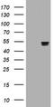 Thymidine phosphorylase antibody, TA800999BM, Origene, Western Blot image 