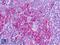 NRAMP1 antibody, LS-B9344, Lifespan Biosciences, Immunohistochemistry paraffin image 