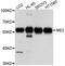 Malic Enzyme 2 antibody, A9650, ABclonal Technology, Western Blot image 
