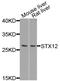 Syntaxin 12 antibody, A09232, Boster Biological Technology, Western Blot image 