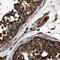 CG1 antibody, PA5-53652, Invitrogen Antibodies, Immunohistochemistry frozen image 