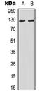 Tensin 2 antibody, LS-C368623, Lifespan Biosciences, Western Blot image 