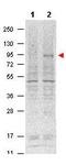Signal Transducer And Activator Of Transcription 5A antibody, P01087, Boster Biological Technology, Western Blot image 