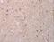 AKT Serine/Threonine Kinase 2 antibody, LS-C406108, Lifespan Biosciences, Immunohistochemistry frozen image 