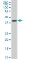 NFKB Inhibitor Beta antibody, H00004793-M04, Novus Biologicals, Western Blot image 