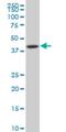 NFKB Inhibitor Beta antibody, H00004793-M04, Novus Biologicals, Western Blot image 