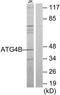 Autophagy Related 4B Cysteine Peptidase antibody, TA311695, Origene, Western Blot image 