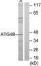 Autophagy Related 4B Cysteine Peptidase antibody, TA311695, Origene, Western Blot image 