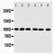 Protein Inhibitor Of Activated STAT 1 antibody, orb176694, Biorbyt, Western Blot image 