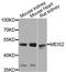 Meis Homeobox 2 antibody, A04264, Boster Biological Technology, Western Blot image 
