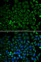 Parkin RBR E3 Ubiquitin Protein Ligase antibody, STJ113001, St John