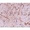 Translocase Of Outer Mitochondrial Membrane 70 antibody, LS-C82894, Lifespan Biosciences, Immunohistochemistry frozen image 