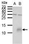 Peptidase Inhibitor 3 antibody, PA5-35877, Invitrogen Antibodies, Western Blot image 