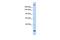 Trinucleotide Repeat Containing Adaptor 6B antibody, GTX47312, GeneTex, Western Blot image 