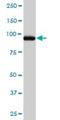 Activating Signal Cointegrator 1 Complex Subunit 2 antibody, H00084164-B01P, Novus Biologicals, Western Blot image 