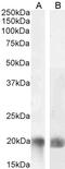 Phosphatidylinositol-3,4,5-Trisphosphate Dependent Rac Exchange Factor 1 antibody, 42-175, ProSci, Western Blot image 