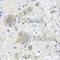 Serine Hydroxymethyltransferase 1 antibody, A7727, ABclonal Technology, Immunohistochemistry paraffin image 