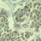 Eukaryotic Translation Initiation Factor 2 Subunit Alpha antibody, AP0341, ABclonal Technology, Immunohistochemistry paraffin image 