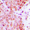 Zinc Finger Protein 134 antibody, LS-C354556, Lifespan Biosciences, Immunohistochemistry paraffin image 