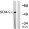 SRY-Box 9 antibody, LS-B5761, Lifespan Biosciences, Western Blot image 