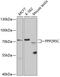 Protein Phosphatase 2 Regulatory Subunit B'Gamma antibody, 19-690, ProSci, Western Blot image 