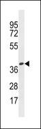 Olfactory Receptor Family 4 Subfamily X Member 1 (Gene/Pseudogene) antibody, LS-C158477, Lifespan Biosciences, Western Blot image 