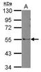 Rho GTPase Activating Protein 36 antibody, PA5-31619, Invitrogen Antibodies, Western Blot image 