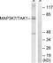 Mitogen-Activated Protein Kinase Kinase Kinase 7 antibody, TA313024, Origene, Western Blot image 