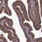 Interferon Related Developmental Regulator 2 antibody, HPA068560, Atlas Antibodies, Immunohistochemistry paraffin image 