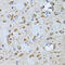 Pyruvate Dehyrogenase Phosphatase Catalytic Subunit 1 antibody, 22-135, ProSci, Immunohistochemistry frozen image 