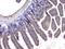 Histone Deacetylase 5 antibody, A01230-5, Boster Biological Technology, Immunohistochemistry paraffin image 