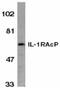 Interleukin 1 Receptor Accessory Protein antibody, ab8110, Abcam, Western Blot image 