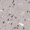 Cleavage Stimulation Factor Subunit 3 antibody, NBP1-85428, Novus Biologicals, Immunohistochemistry paraffin image 