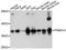 Proteasome 26S Subunit, Non-ATPase 14 antibody, abx126421, Abbexa, Western Blot image 