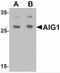 Androgen Induced 1 antibody, NBP2-41166, Novus Biologicals, Western Blot image 