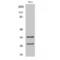 Caspase 6 antibody, LS-C380448, Lifespan Biosciences, Western Blot image 