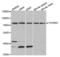 Transforming Growth Factor Beta Receptor 2 antibody, abx001227, Abbexa, Western Blot image 