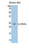 Insulin Like Growth Factor Binding Protein 6 antibody, LS-C294664, Lifespan Biosciences, Western Blot image 