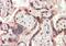 Teratocarcinoma-Derived Growth Factor 1 antibody, PA5-18951, Invitrogen Antibodies, Immunohistochemistry paraffin image 