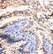 Vinculin antibody, PA1781, Boster Biological Technology, Immunohistochemistry paraffin image 