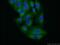Trafficking From ER To Golgi Regulator antibody, 11571-1-AP, Proteintech Group, Immunofluorescence image 