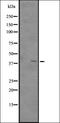 Alpha Kinase 3 antibody, orb337657, Biorbyt, Western Blot image 