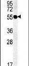 Transmembrane protein 79 antibody, PA5-25210, Invitrogen Antibodies, Western Blot image 