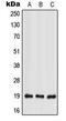 Interferon Lambda 2 antibody, MBS821677, MyBioSource, Western Blot image 