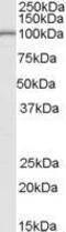 La Ribonucleoprotein Domain Family Member 1B antibody, GTX89042, GeneTex, Western Blot image 