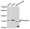 Protein Phosphatase 2 Regulatory Subunit B'Gamma antibody, A5480, ABclonal Technology, Western Blot image 