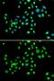 H2A Histone Family Member Y antibody, GTX32709, GeneTex, Immunocytochemistry image 