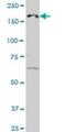 Lysine Demethylase 5B antibody, H00010765-M02, Novus Biologicals, Western Blot image 