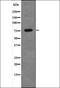 Arachidonate 5-Lipoxygenase antibody, orb336026, Biorbyt, Western Blot image 
